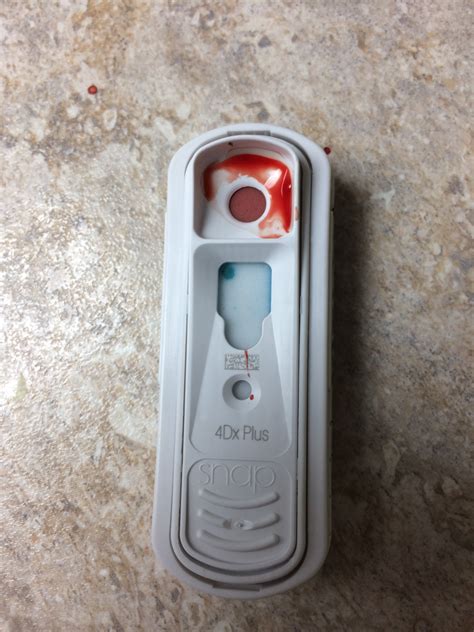 heartworm test 4dx